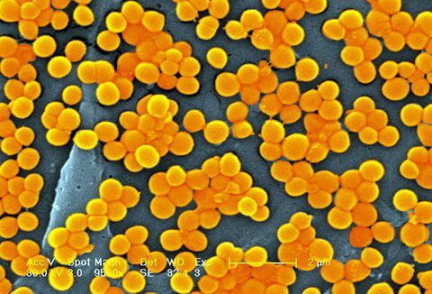 الميثيسيلين مقاومة البكتيريا المكورات العنقودية الذهبية